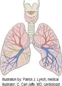 Diagram of lungs showing the small pulmonary capillaries